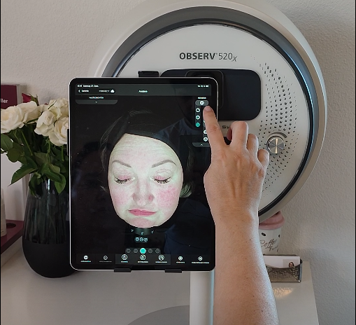 Hautanalyse mit OBSERV 520x: Analysegerät mit Hautbild auf dem Tablet bei Rund um Schön in Horgau