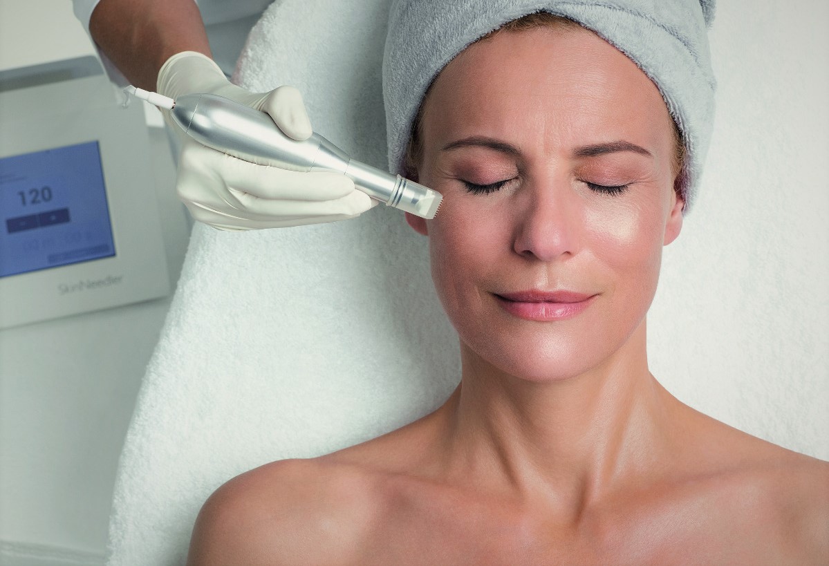 Microneedling-Behandlung: Hautneedler-Handstück mit sterilem Aufsatz bei Rund um Schön in Horgau